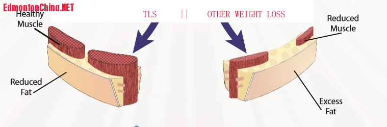 tls-reducefat.jpg