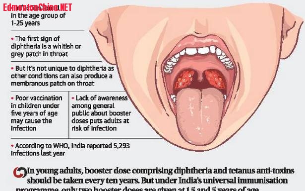 15hy diftheriacol.jpg